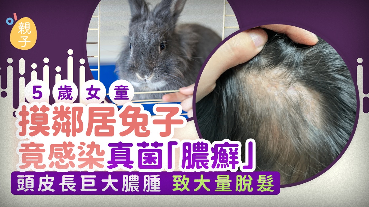 5岁女童摸兔子染头癣！医生提醒：这些宠物接触后要当心