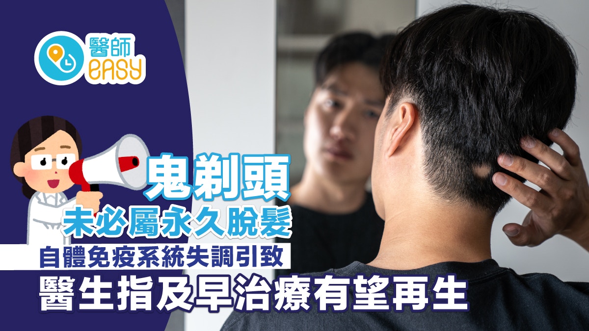 头皮突然秃一块？医师解析「鬼剃头」成因与治疗关键